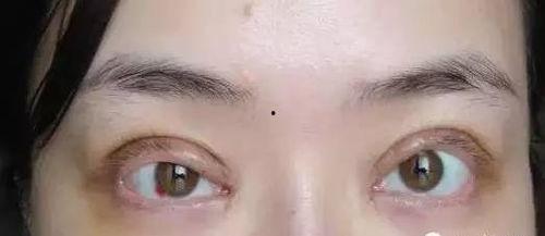 郑州双眼皮爆料案件最新,揭秘整形纠纷背后的真相与反思